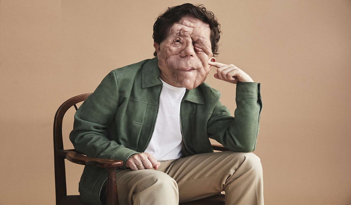 Reclaiming the Mask: Why Adam Pearson is the First "Elephant Man" to Finally Tell His Own Story