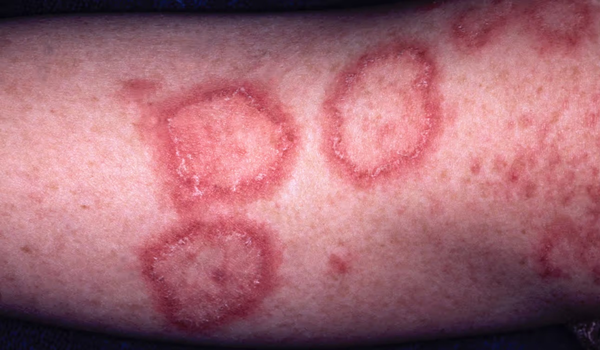 The Body at War with Itself: Why Millions of Women Are Navigating a Medical Blind Spot